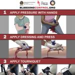 ‘Stop the Bleed’ training at Orcas school