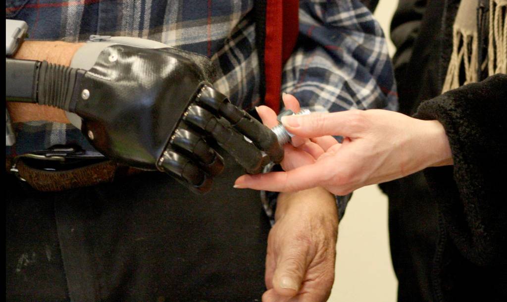San Juan Islander receives bionic hand after accident