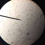 Contributed photo
What a heterosigma bloom looks like under the microscope.