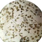 Contributed photo
View of a plankton bloom through the microscope
